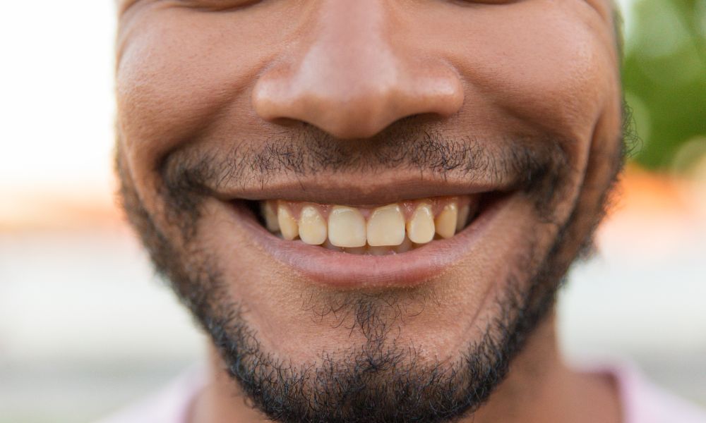 Comprendre le jaunissement des dents